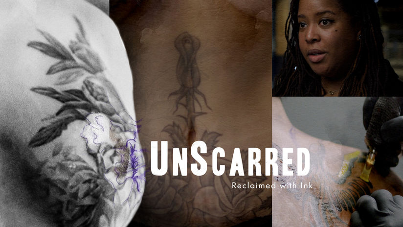 "Unscarred" Feature Documentary Teaser